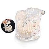 Lehrmodell Anatomie, 10 Dental Demonstration Zähne Modell Transparent Erwachsene Pathologien Dental Zahnarzt Oral Reparatur Pathologisches aktives Zahnmodell for medizinische Wissenschaft U