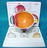Modell Anatomies Krank menschlicher Augapfel Augenverletzung Auge Hornhaut Katarakt Augen Modell Querschnitt Medical E