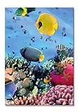 Pixxprint Glasbild | Wandbild aus Echtglas | Fische im Korallenriff | 40x60 cm | inkl. Aufhängung und Ab